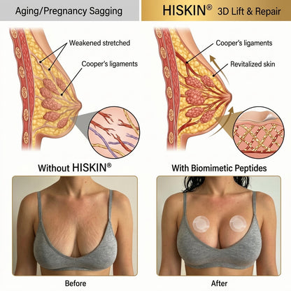 💥𝐇𝐈𝐒𝐊𝐈𝐍® 👩‍⚕️ Targeted Breast Enhancement Advanced Nano Microneedle Patch💃